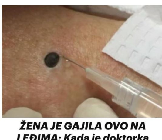 ŽENA JE GAJILA OVO NA LEĐIMA: Kada je doktorka uzela špric i bocnula, shvatit ćete zašto je SNIMAK pregledalo 33 miliona ljudi!