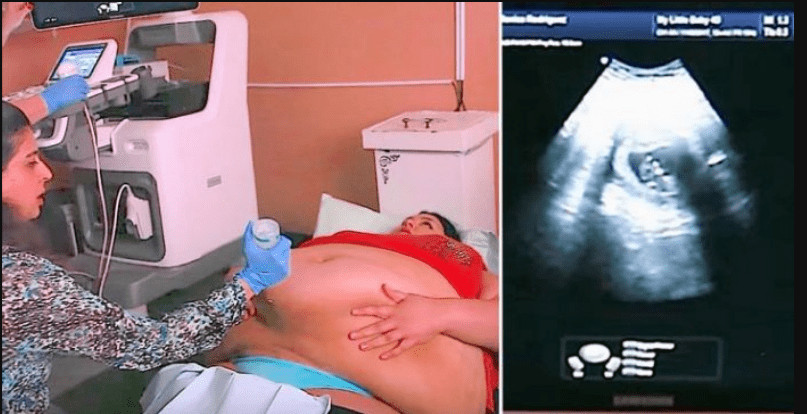 Trudna žena ima 226 kilograma i došla je na ultrazvuk, a onda je medicinska sestra podigla njen stomak i pogledala bolje… (VIDEO) - featured image Trudna žena ima 226 kilograma i došla je na ultrazvuk, a onda je medicinska sestra podigla njen stomak i pogledala bolje… (VIDEO) - featured image