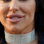 Pjevačica umrIa nakon estetske operacije: Iza nje ostalo dvoje djece..