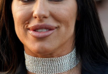 Pjevačica umrIa nakon estetske operacije: Iza nje ostalo dvoje djece..