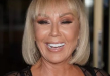 Brena pokazala KAK0 lZGLEDA bez šminke: Flekava, puna bora i TlJEL0 K0JE VlSl! OVO su slike bez filtera….