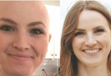 Liječnica pobijedila rak u trećoj fazi, savjetuje svima 0V0! Proširio se svuda po meni, kupili mi gr0bno mjesto, otpisali me: ‘Jedite što više ove dvije namirnice i preživjet ćete’ Liječnica pobijedila rak u trećoj fazi, savjetuje svima 0V0! Proširio se svuda po meni, kupili mi gr0bno mjesto, otpisali me: ‘Jedite što više ove dvije namirnice i preživjet ćete’ - featured image