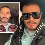 Estradni frizer koji je umro na Badnji dan imao problem sa zubima! 2 mjeseca pred smrt pričao kroz šta prolazi Estradni frizer koji je umro na Badnji dan imao problem sa zubima! 2 mjeseca pred smrt pričao kroz šta prolazi - featured image