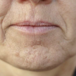 Simptom DEMENCIJE koji se javlja u ustima: Ako ga osjetite, obratite se ljekaru!