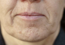 Simptom DEMENCIJE koji se javlja u ustima: Ako ga osjetite, obratite se ljekaru!