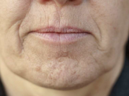 Simptom DEMENCIJE koji se javlja u ustima: Ako ga osjetite, obratite se ljekaru!