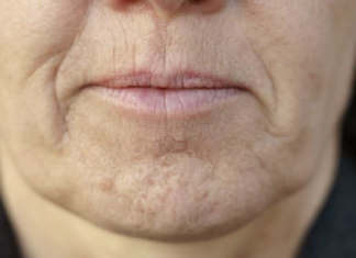 Simptom DEMENCIJE koji se javlja u ustima: Ako ga osjetite, obratite se ljekaru!