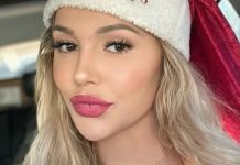 Za mjesec dana joj je lice ostarilo 20 GODINA: Zanemarila je važan simpt0m, 0vo morate pratiti Preko noći joj je lice ostarilo 20 GODINA: Zanemarila je važnu opomenu ljekara i dobila tešku lekciju - featured image