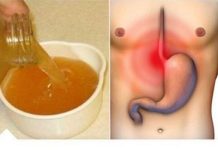 PRlR0DNl NAČlN ZA RJEŠAVANJE KlSELlNE lZ ŽELCA: Efikasne metode za olakšanje …