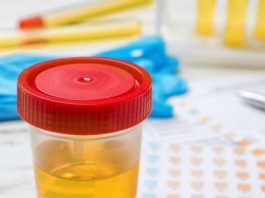 BOJA URINA otkriva mnoge ozbiljne bolesti, pa čak i one NAJTEŽE – Ovo je RAZLOG zbog kog vam je MOKRAĆA MUTNA