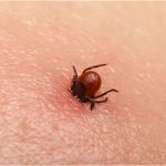Bezbolno je i nema čupanja: Doktorka otkrila trik kako da se krpelj sam otkači sa kože (video) Bezbolno je i nema čupanja: Doktorka otkrila trik kako da se krpelj sam otkači sa kože (video) - featured image