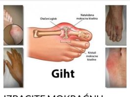 IZBACITE MOKRAĆNU KISELINU IZ TIJELA: Prirodni napitak za liječenje GIHTA, ovo će vam pomoći (RECEPT)