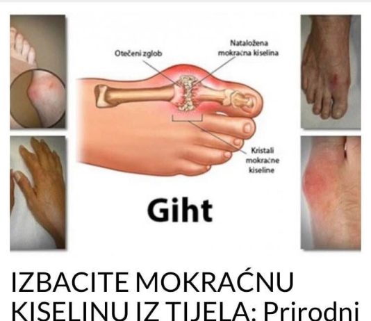 IZBACITE MOKRAĆNU KISELINU IZ TIJELA: Prirodni napitak za liječenje GIHTA, ovo će vam pomoći (RECEPT)
