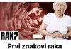 Simptomi raka debelog crijeva kod žena koje trebate znati