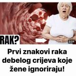 Simptomi raka debelog crijeva kod žena koje trebate znati