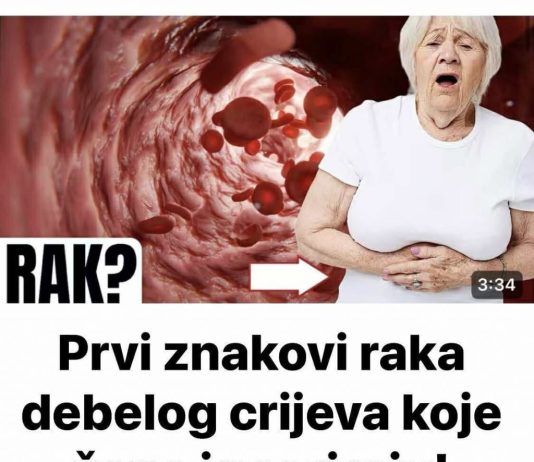 Simptomi raka debelog crijeva kod žena koje trebate znati