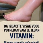DA IZBACITE VIŠAK VODE POTREBAN VAM JE JEDAN VITAMIN: Ni noge vam više neće oticati, samo ga ubacite u ishranu