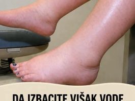 DA IZBACITE VIŠAK VODE POTREBAN VAM JE JEDAN VITAMIN: Ni noge vam više neće oticati, samo ga ubacite u ishranu