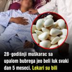 Jeo je beli luk svaki dan 5 meseci — Šta se desilo sa njegovim bubrezima iznenadilo je lekare 😳