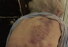 Vratila sam se kući kako bih pomogla svojoj starijoj majci da se okupa. Čim sam krenula prema njoj, trgnula se kao da ću je udariti