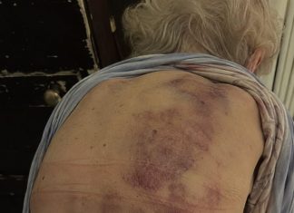 Vratila sam se kući kako bih pomogla svojoj starijoj majci da se okupa. Čim sam krenula prema njoj, trgnula se kao da ću je udariti